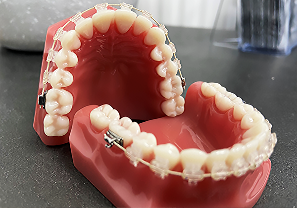 dental-smile-model